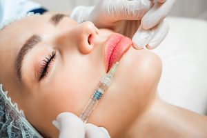 hyaluronic acid application in woman's lips during aesthetic treatment session