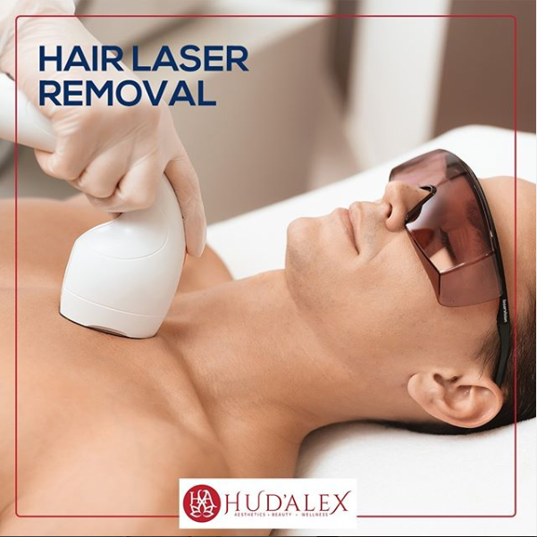 Laser hair removal