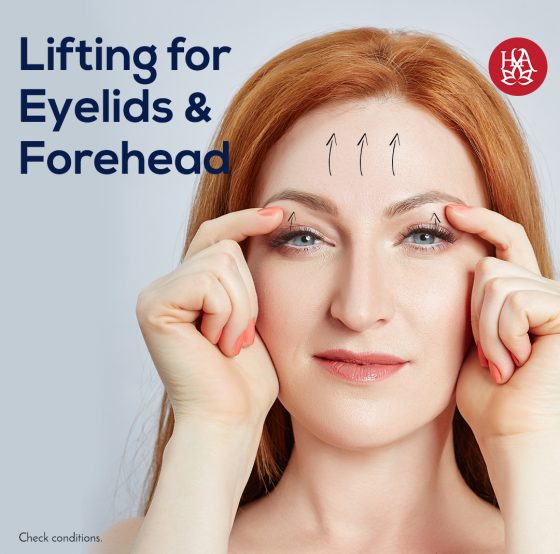 2 areas for the price of 1: Eyelids and forehead lifting