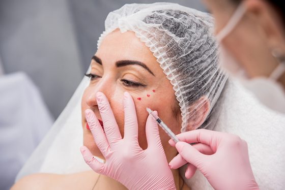 Why are dermal fillers so popular?